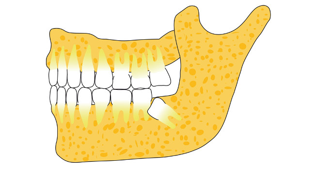 Aktuelles von Ihrem Oralchirurgen / Kieferchirurgen Würzburg